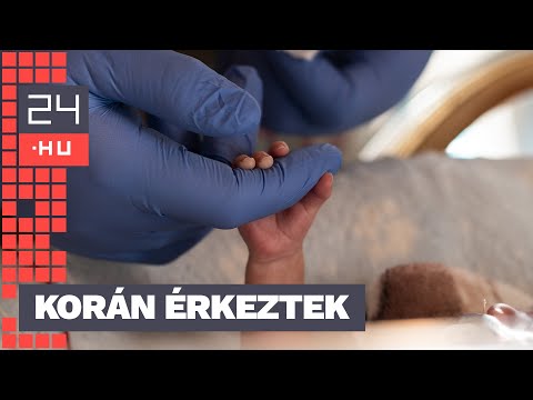 „Látni ezeket a kicsiket, hogy milyen küzdelem van bennük” – újszülött intenzív osztályon jártunk